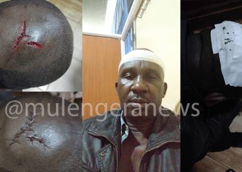 Fearing for His Life, Clobbered NUP Cadre Flees His Buddo Home-Now Hiding in Gombe Butambala