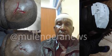 Fearing for His Life, Clobbered NUP Cadre Flees His Buddo Home-Now Hiding in Gombe Butambala