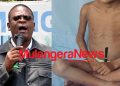 Like UPC’s Akena Did Recently, PFF’s Dr Lulume Sounds Malnutrition Alarm as Drought Leaves Ugandans Dying