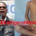 Like UPC’s Akena Did Recently, PFF’s Dr Lulume Sounds Malnutrition Alarm as Drought Leaves Ugandans Dying